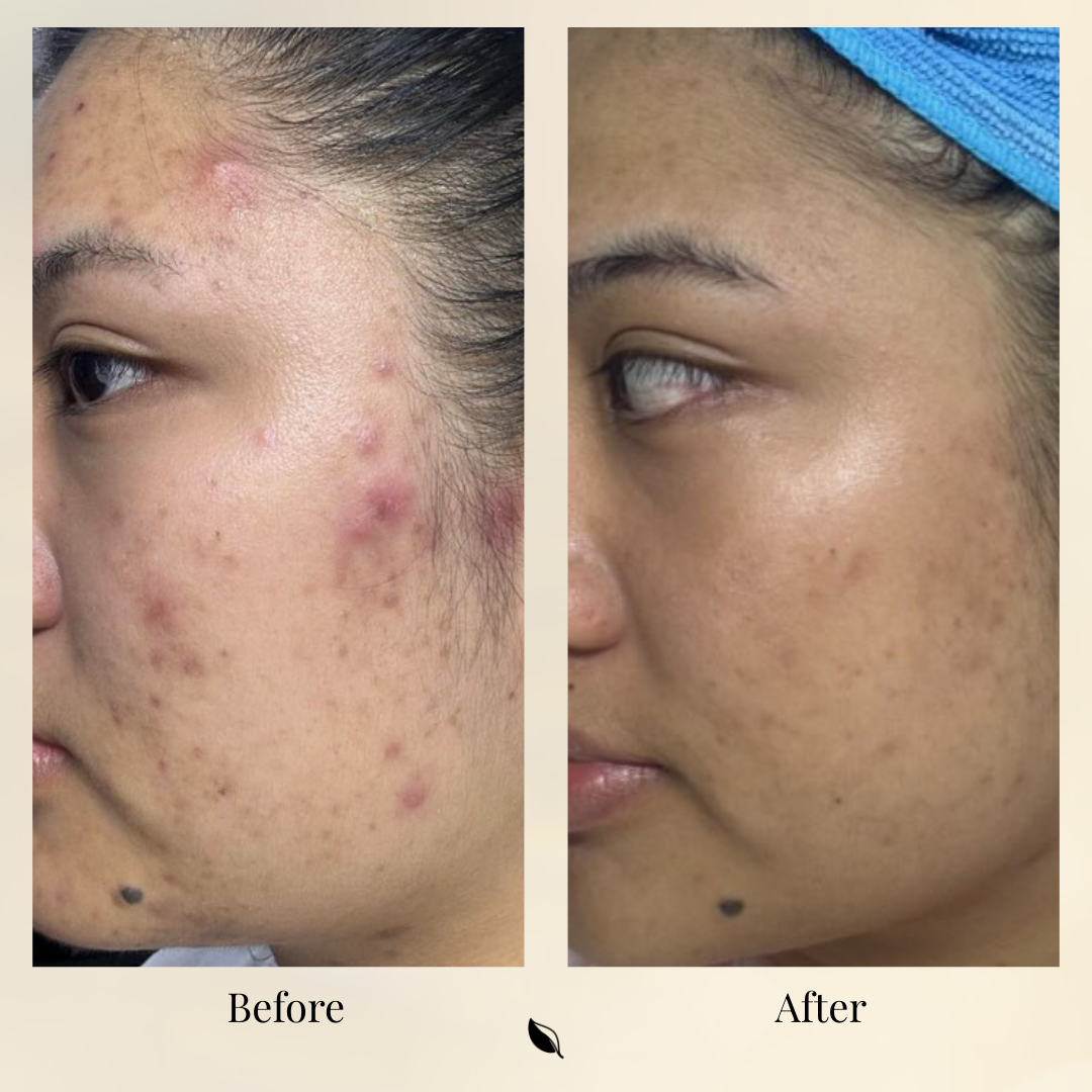 Bioactive Caviar Dark Spot Corrector