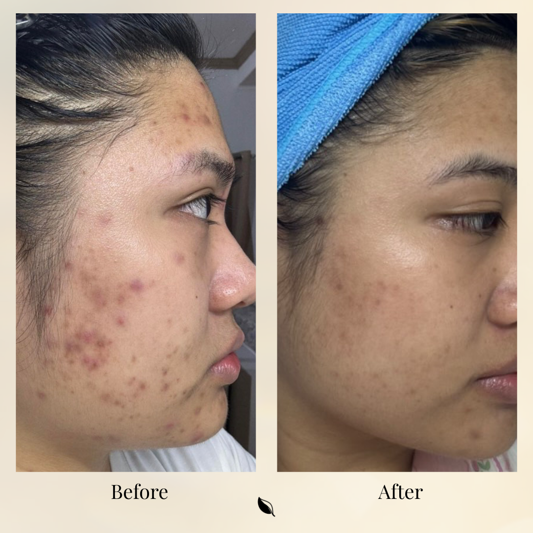 Bioactive Caviar Dark Spot Corrector
