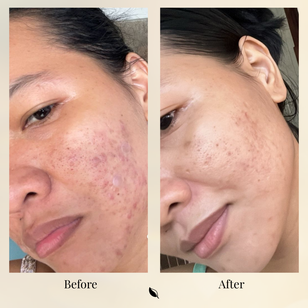 Bioactive Caviar Dark Spot Corrector
