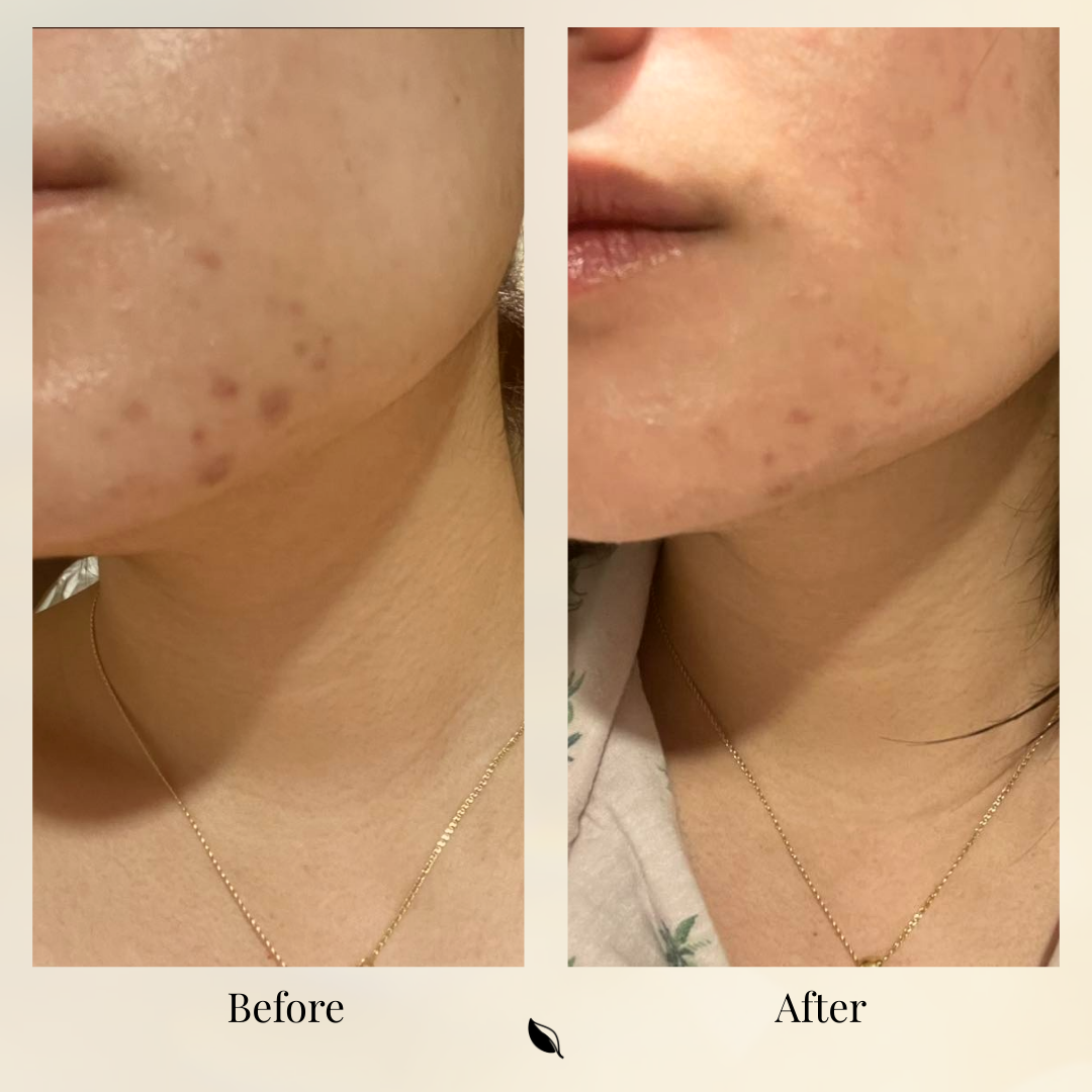 Bioactive Caviar Dark Spot Corrector