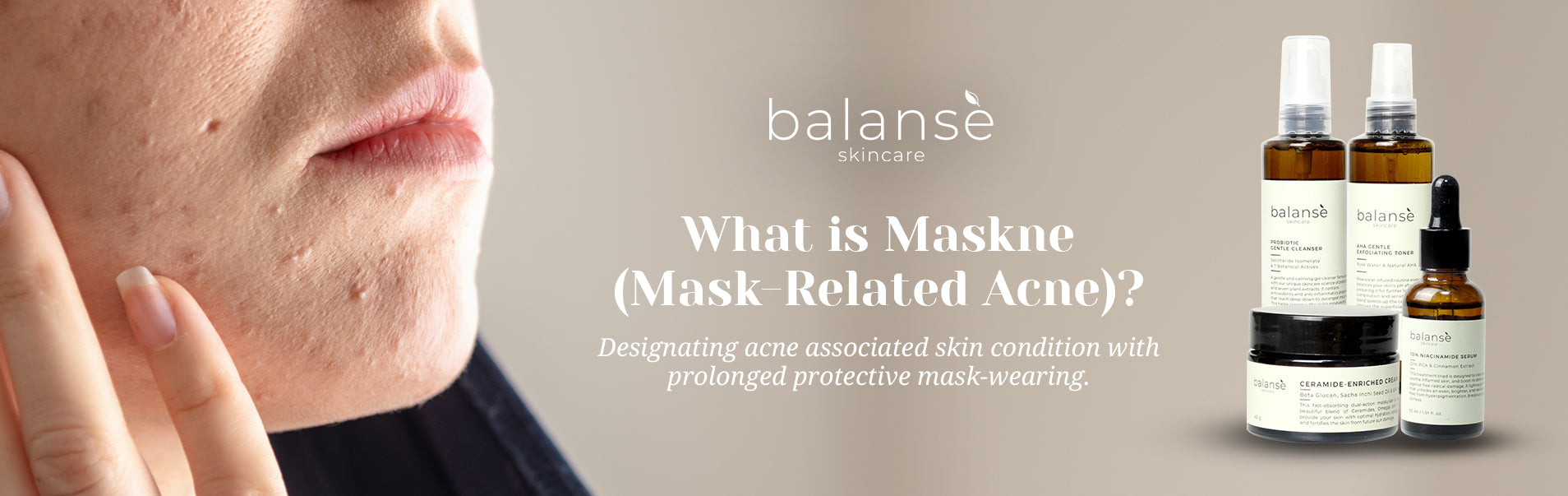 WHAT IS MASKNE (MASK-RELATED ACNE)? balanseph