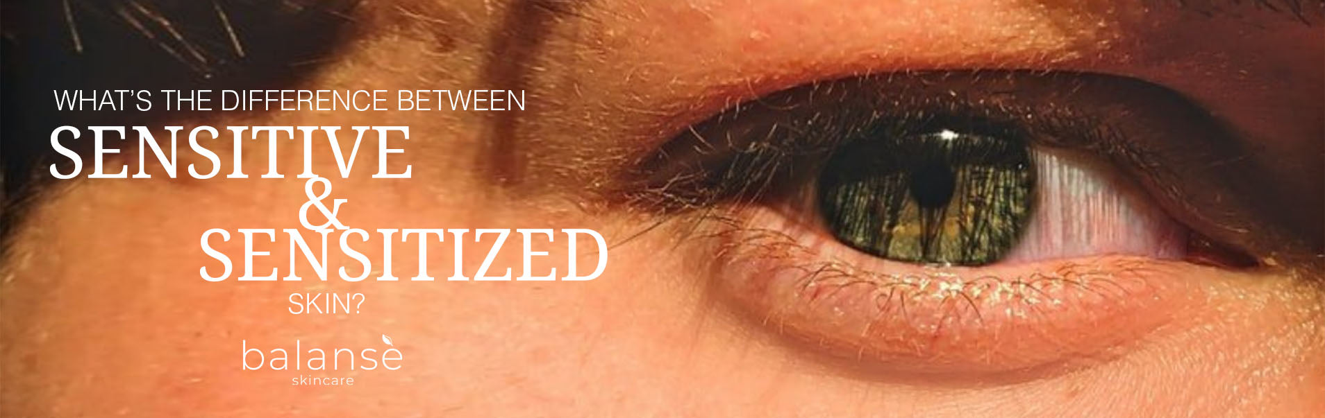 WHATS THE DIFFERENCE BETWEEN SENSITIVE &amp; SENSITIZED SKIN? balanseph