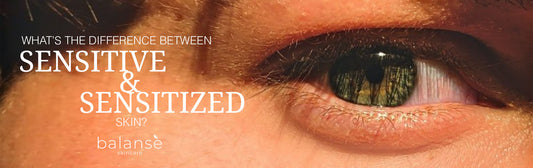 WHATS THE DIFFERENCE BETWEEN SENSITIVE &amp; SENSITIZED SKIN? balanseph