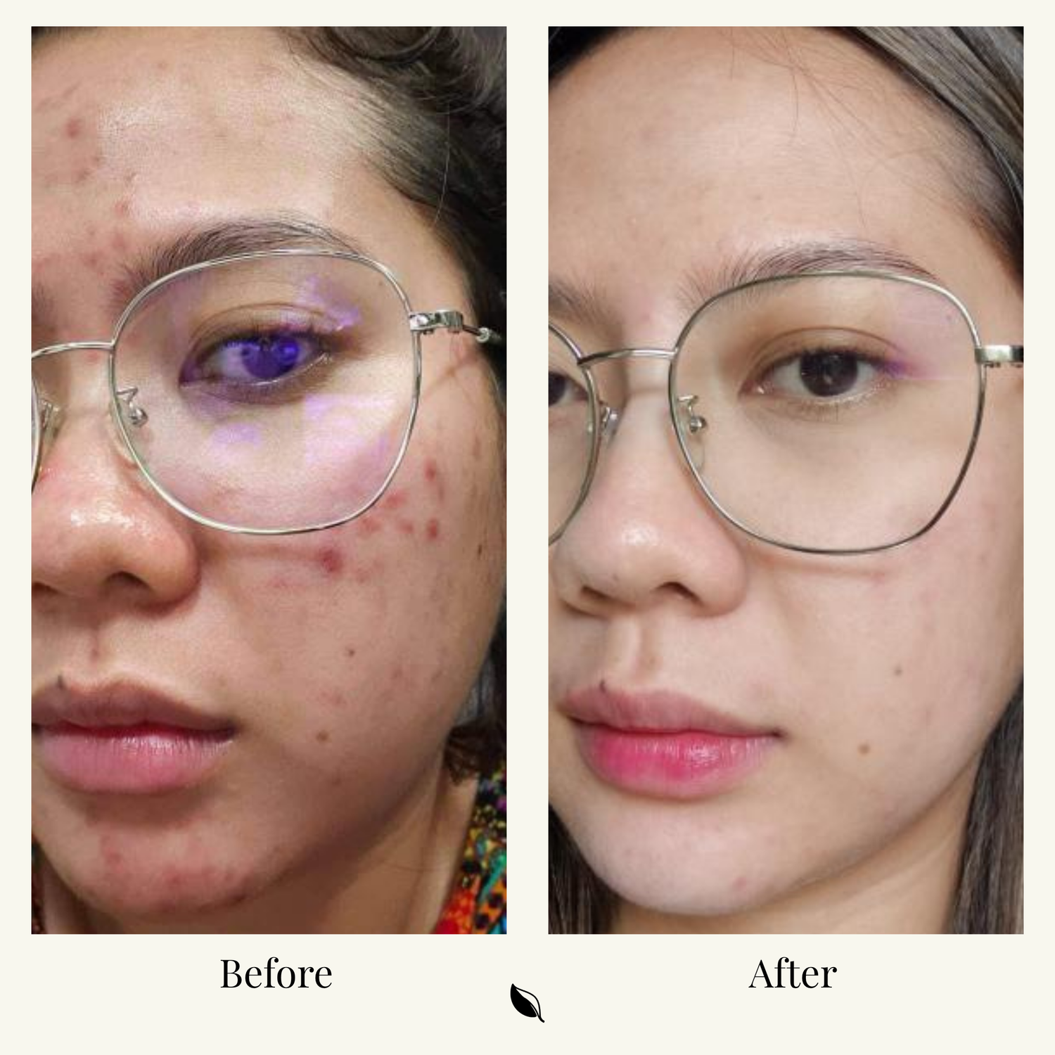 Hannah's Balansè Story