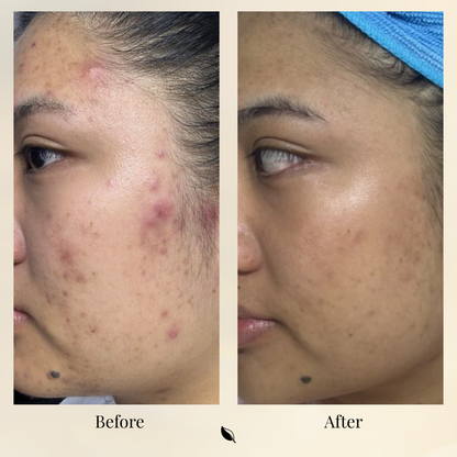 Bioactive Caviar Dark Spot Corrector